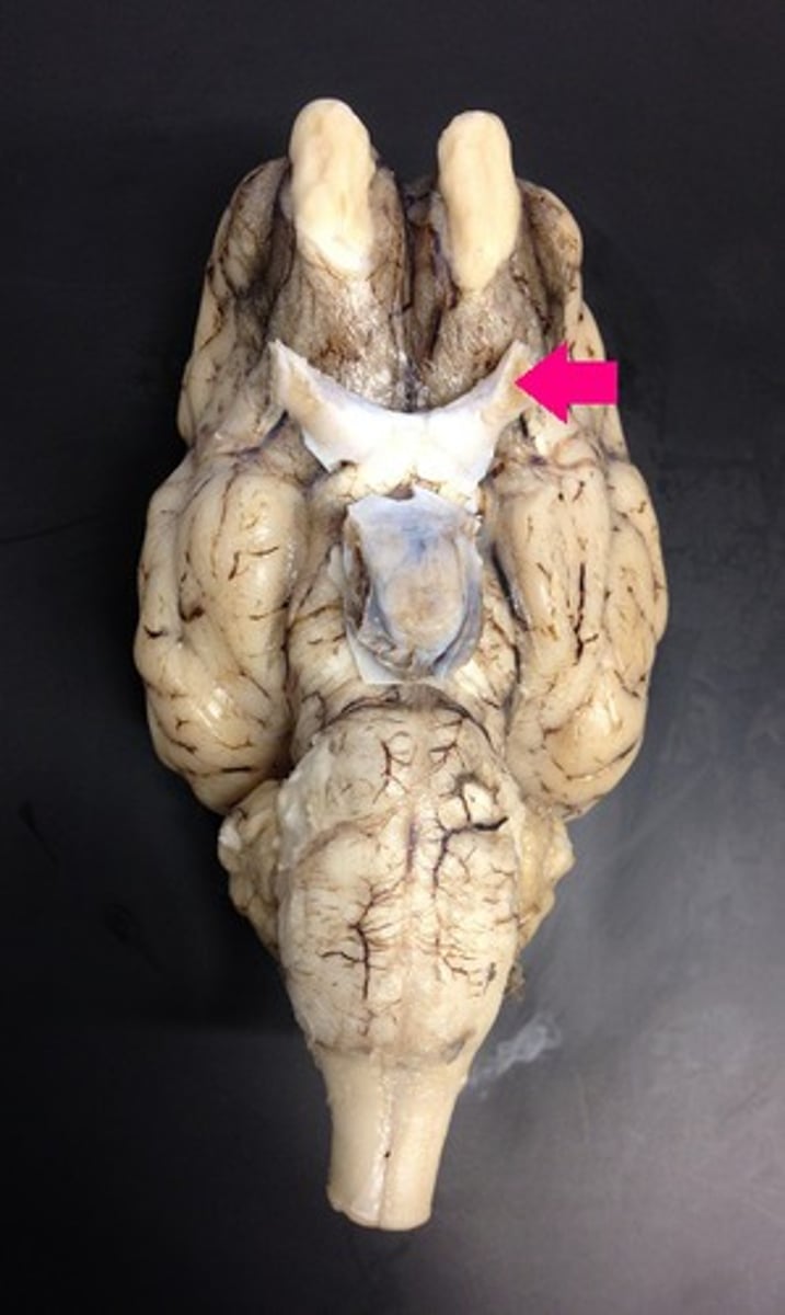 <p>Identify the nerve by name.</p>