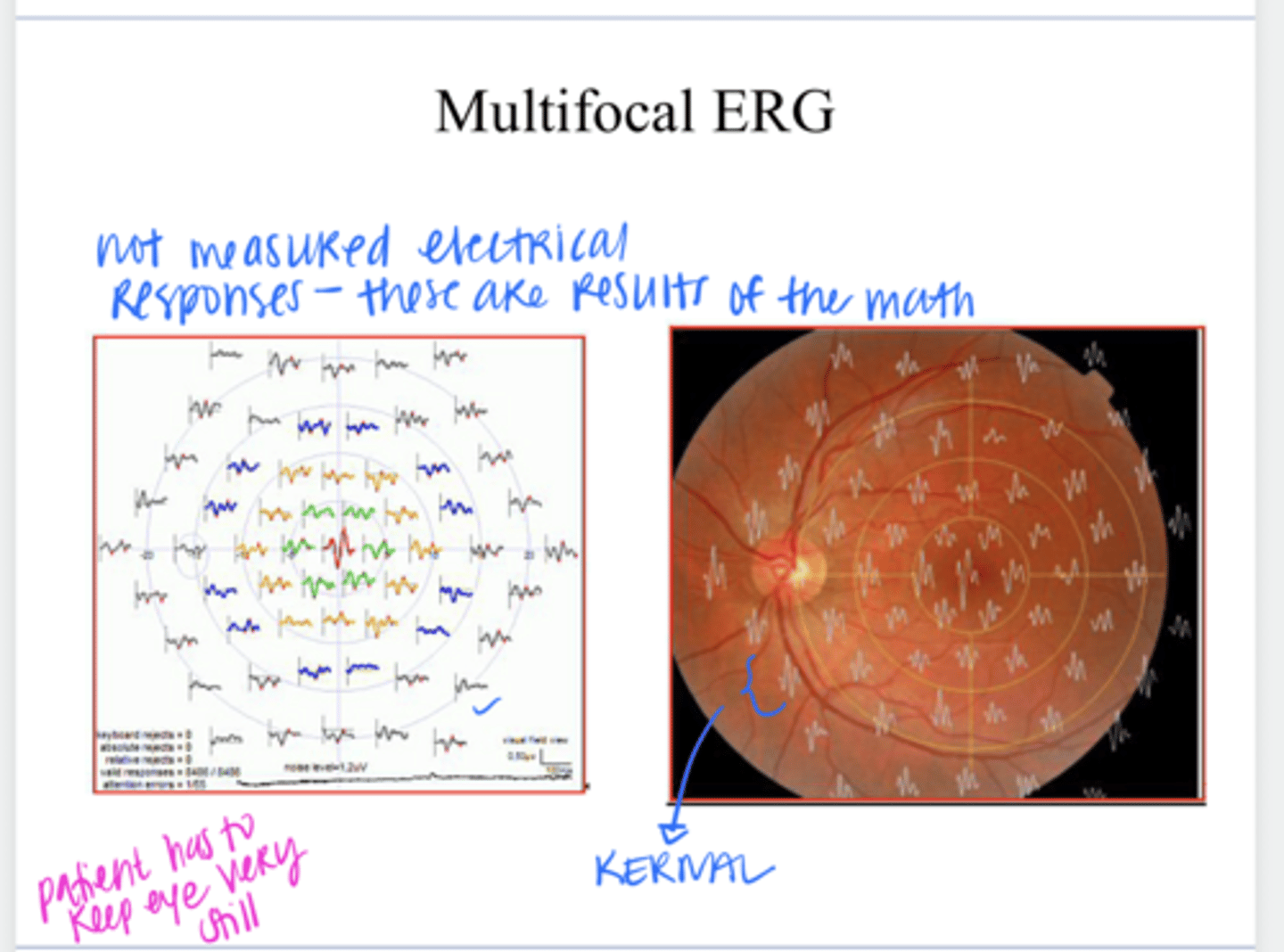 <p>Multifocal ERG Results that Reflect Activity in the Retina (Pic)</p><p>**not measured electrical responses</p>