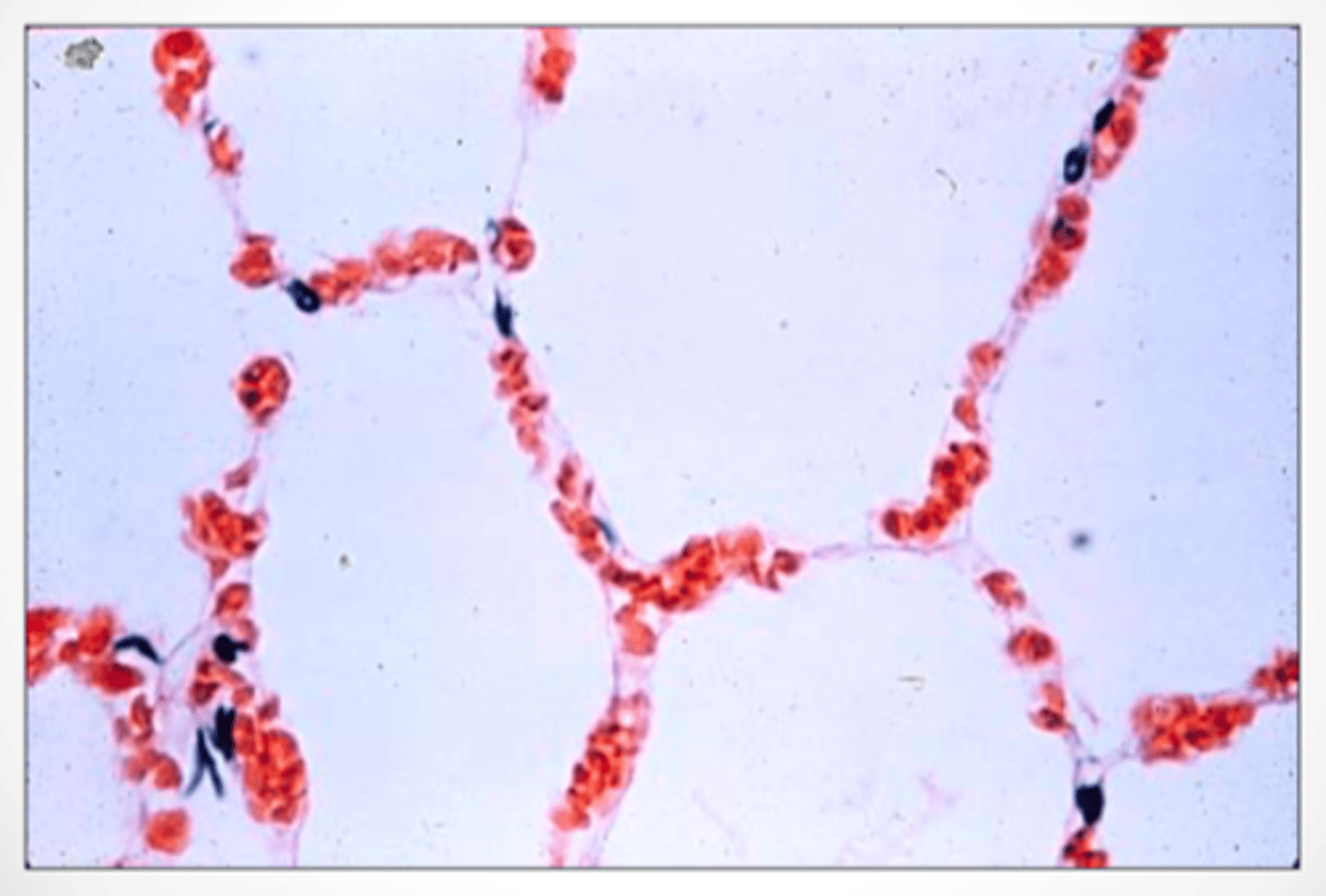 <p>Note that some parts of the capillaries only fit 1 red blood cell in diameter</p>