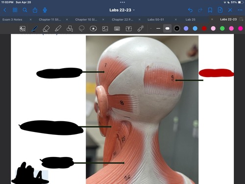 <p>What muscle is this?</p>