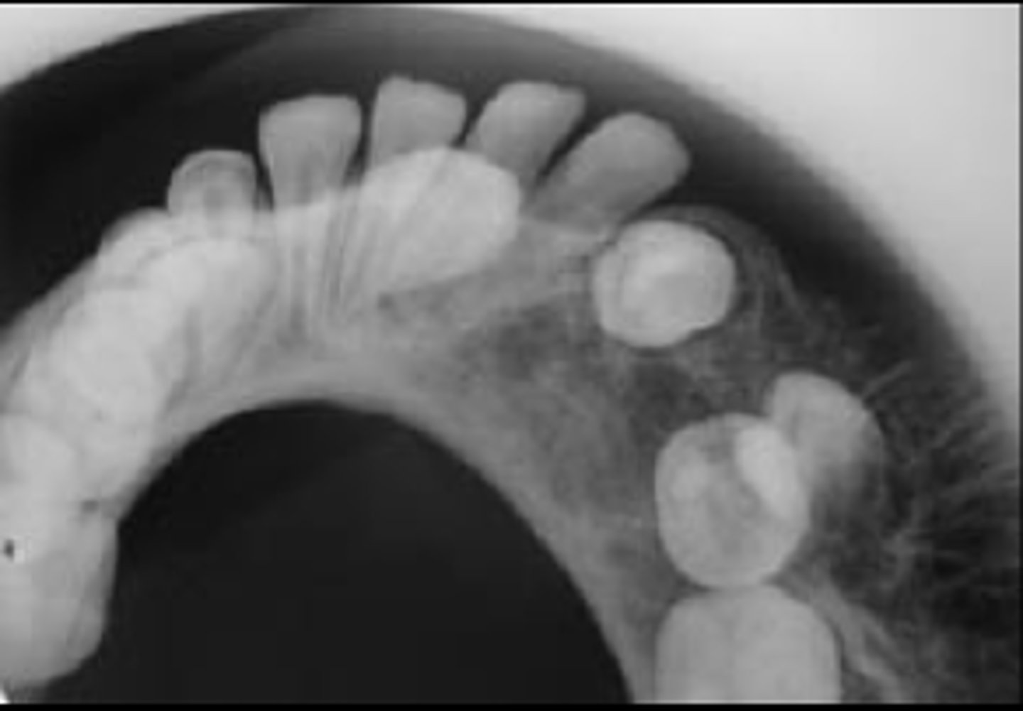 <p>ID the pathology:</p>