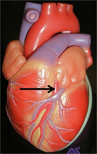 <p>H3</p>