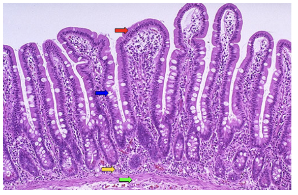 <p><span><strong>Identify structures in small intestine.</strong></span></p>