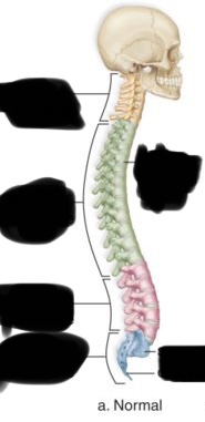 <p>lumbar curvature</p>