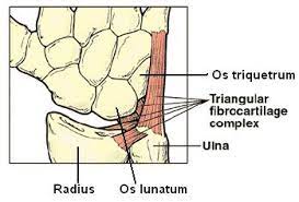 <p></p><ul><li><p>Fibrocart disc dist radioulnar</p></li><li><p>Edges continuous with radioulnar capsular ligs</p></li><li><p>Keeps head of ulna snug against ulnar notch radius</p></li><li><p></p><ul><li><p>stability ulnocarpal joint</p></li></ul></li></ul>