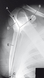 <p>label the anatomy accordingly A-E, the projection/part, and rotation if applicable </p>