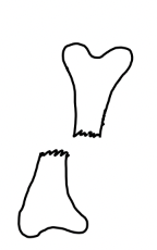 <p><br><span>what type of fracture/bone position is this?</span></p>