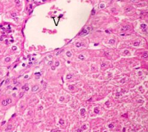 <p>What are the 3 histopathological features of acute (early and reversible) cell injury</p>