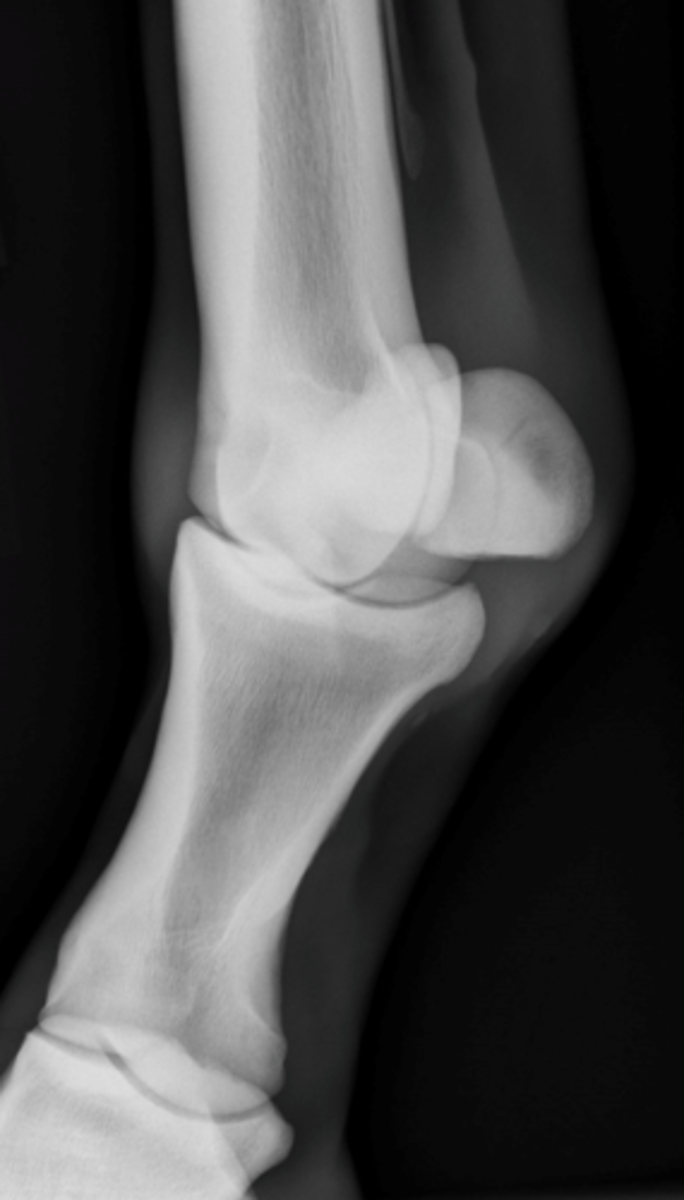 <p>What is highlighted in a DMPLO view of the fetlock?</p>