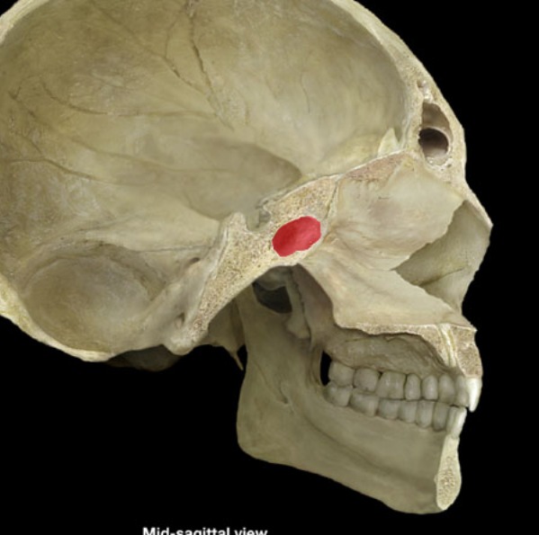 <p>cavity (disarticulated- eyes of bat/butterfly)</p>