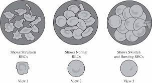 Which of the following best predicts which diagrammed microscope view the laboratory worker would see and best explains why?