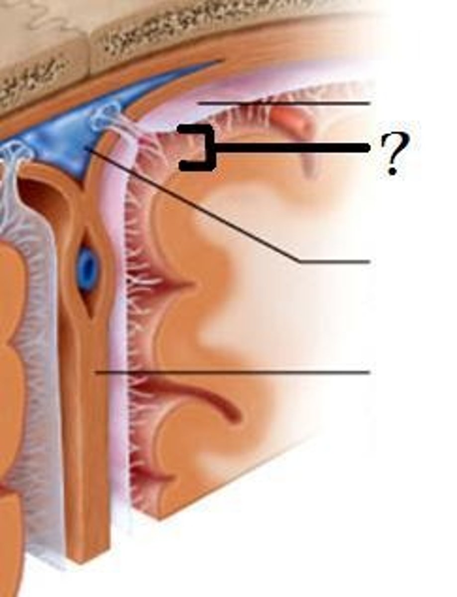 <p>with arachnoid trabeculae</p>