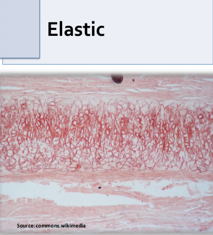 <p>Elastic cartilage </p><p>-chondrocytes form isotonic groups</p><p>-type 2 collagen Fiber</p><p>-abundant elastic fibers</p><p>-in external ear</p>