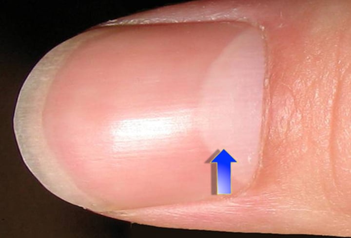 <p>Unit that is about the width of your small fingernail.</p>