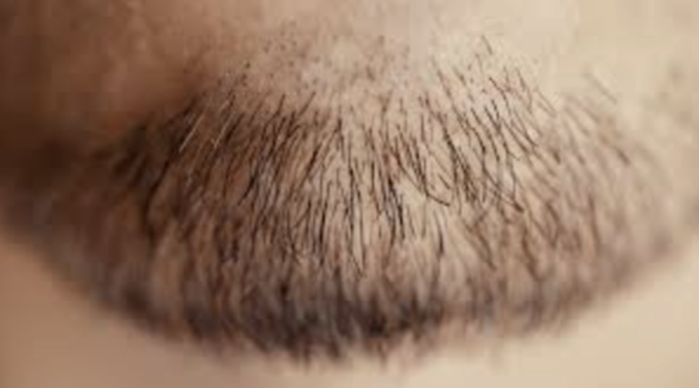 <p>Thick, pigmented hairs, usually found on the head, axilla, pubic areas and face on males</p>