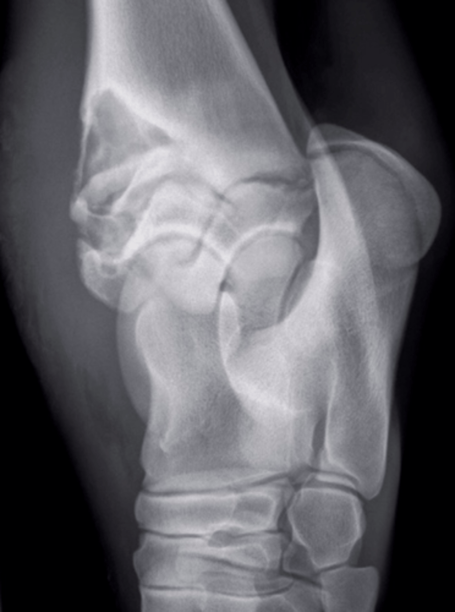 <p>Identify the type of infection?</p>