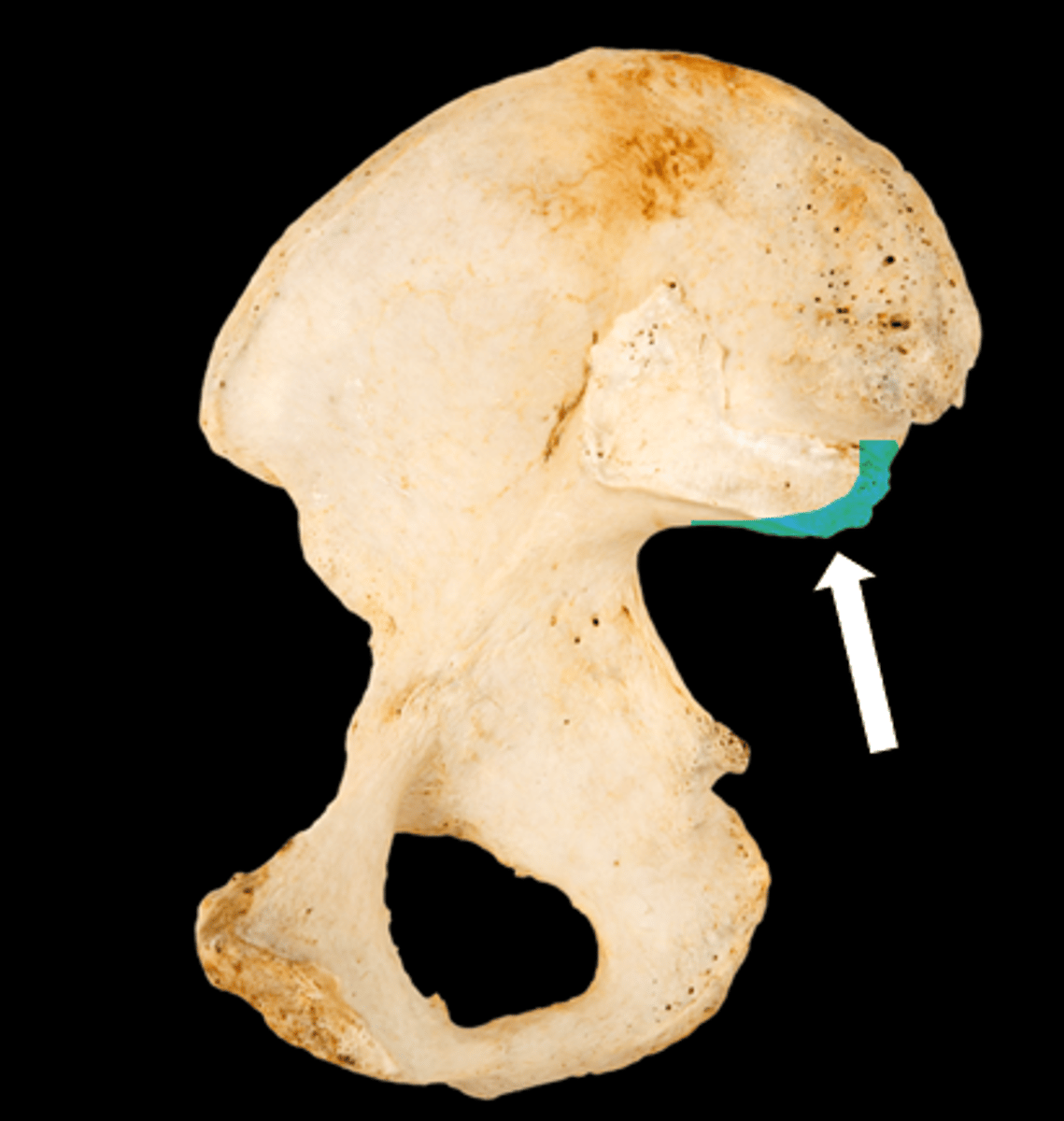 <p>name the part</p>