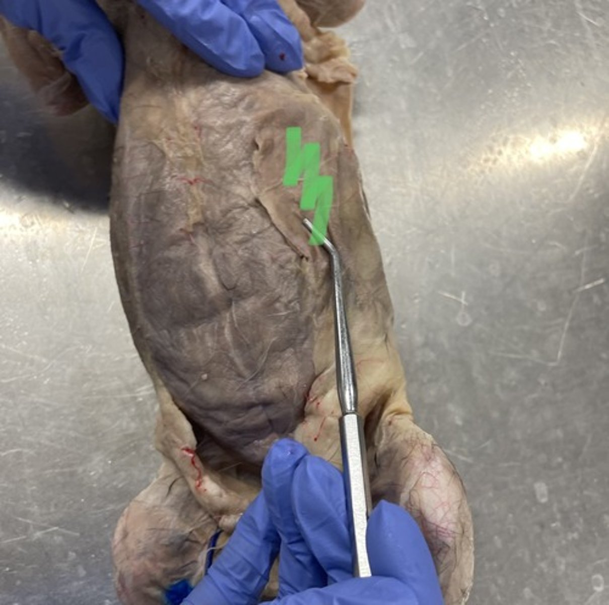 <p>O: lower ribs</p><p>I: linea alba; inguinal ligament</p><p>A: flex trunk; compress abdomen</p>