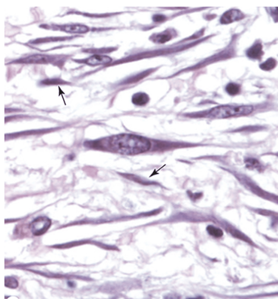 <p>Describe the cytoplasm of fibrocytes.</p>