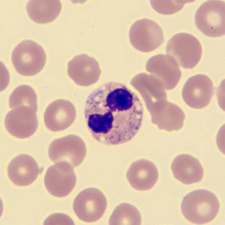 <p>What characteristics is this neutrophil showing?</p>