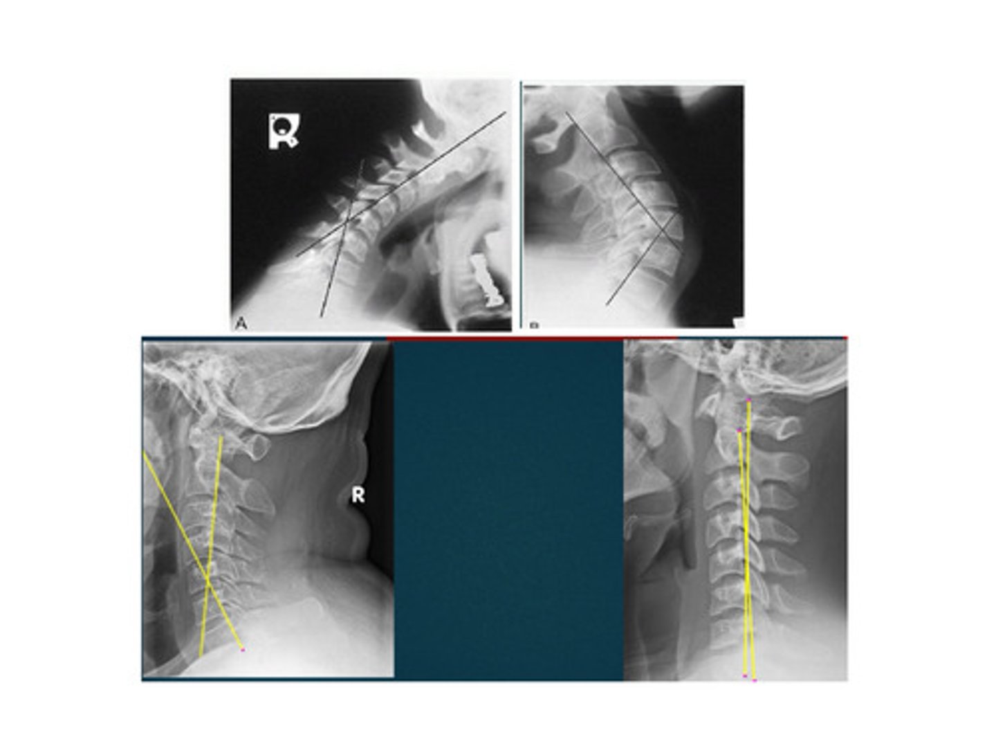<p>What line of mensuration is this?</p>