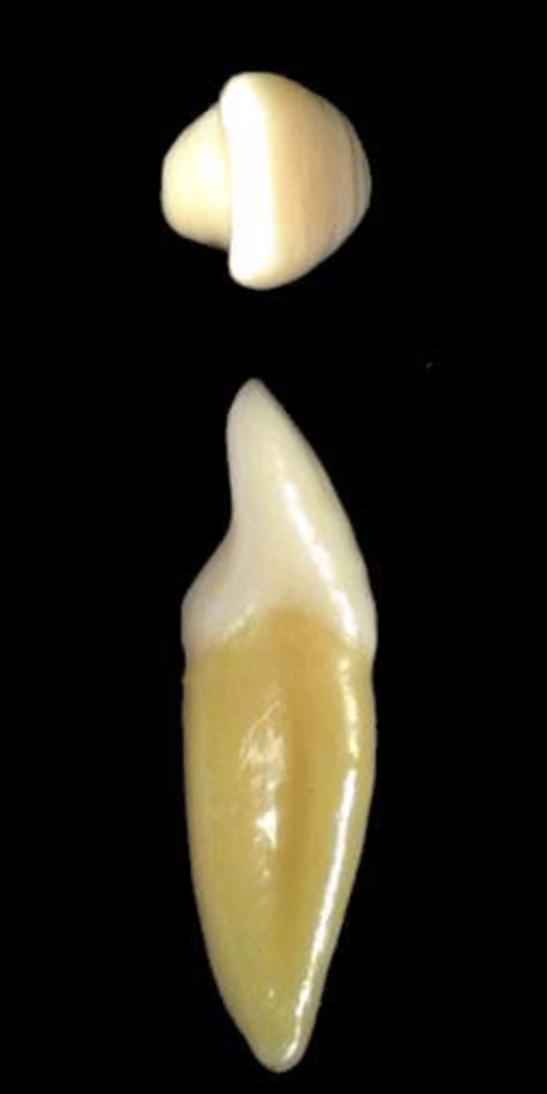 <p>what tooth is this &amp; why?</p>