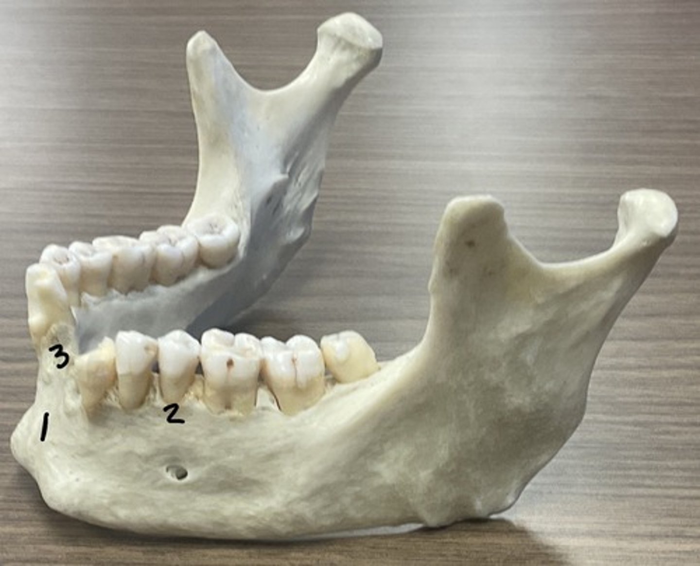 <p>What is structure 3?</p>