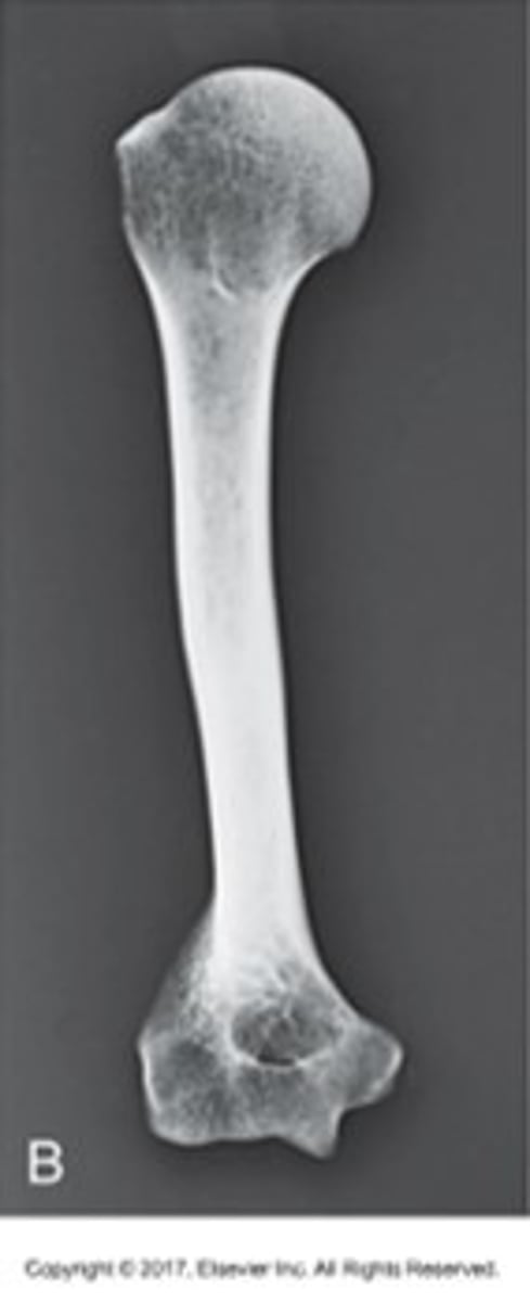 <p>Image appears shorter than actual object because part is not parallel with IR.</p>