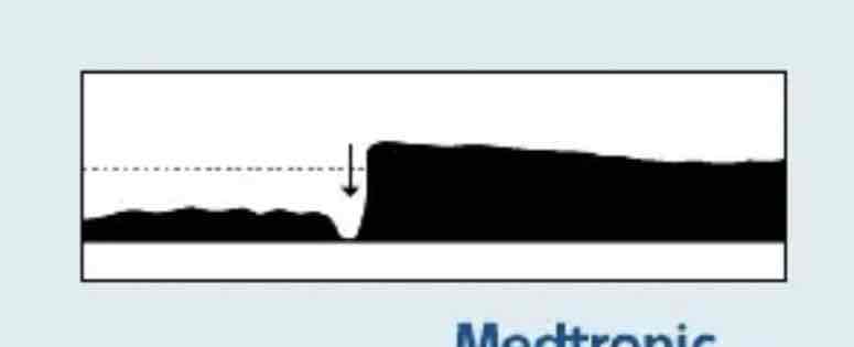 <p>which Capnography waveform is this</p>