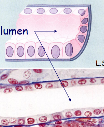 <p>What is this epithelial tissue </p>