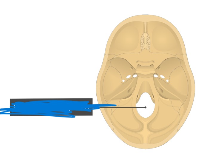 <p>What part of the skull is this?</p>