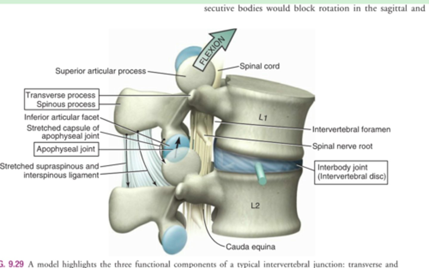 <p>= 2 vertebrae, disk, &amp; facet joints </p><p>“Top moving on Bottom” motion</p><p>Facets glide/slide</p><p>(arthrokinematics)</p><p>Flexion </p><p>anterior-superior slide (top moving) </p><p>= open pack position. </p><p>Extension</p><p>posterior-inferior slide (top moving)</p><p>= closed pack position</p><p>Rotation &amp; Sidebending</p><p>= also top-on-bottom </p>