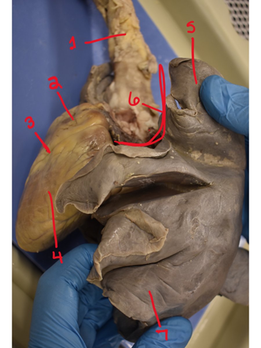 <p>What is structure #1</p>