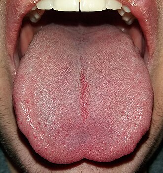 <p>What surface of the tongue is shown in the image?</p>