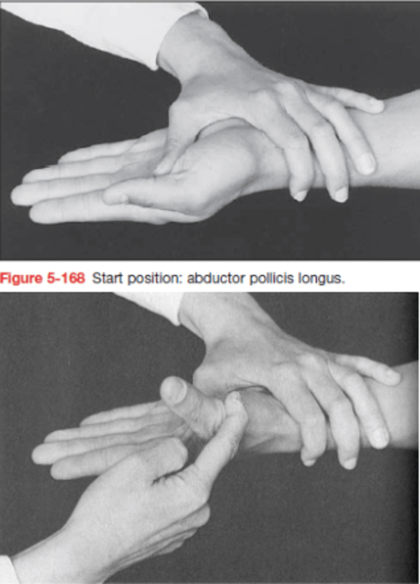 <p>KH: alkar supinatio, I. ujj adductio</p><p>Hüvelykujját távolítsa a II. ujjtól, megemelve azt</p><p>Ellenállás: metacarpusra abductioval szemben</p>