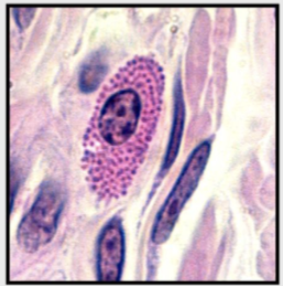 term image
