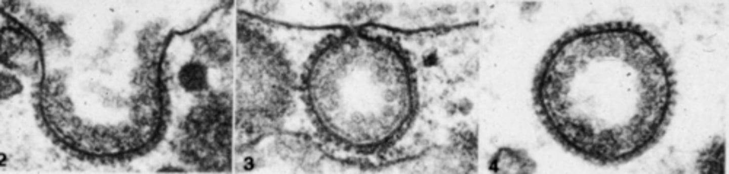 <p>what is the function of this type of vesicle</p>