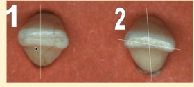 <p><mark data-color="purple" style="background-color: purple; color: inherit">mandibular lateral incisors #23 and #26; incisal edge</mark></p>