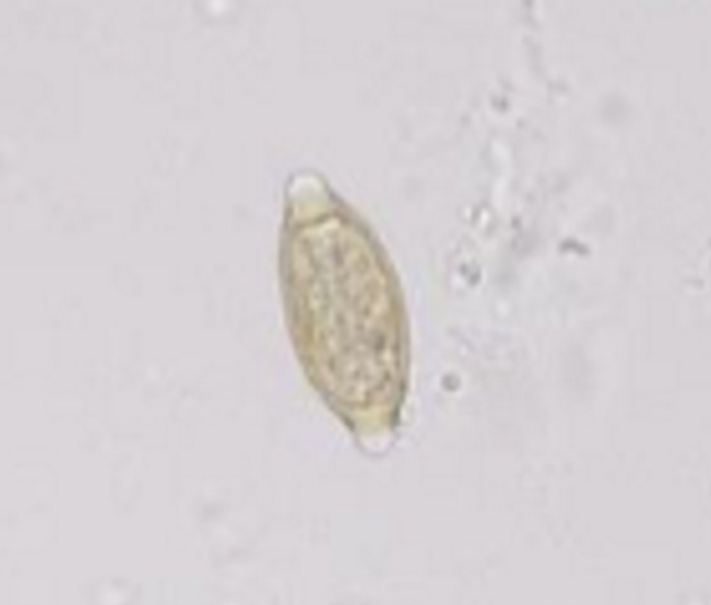 <p>Dogs and Cats</p><p>Small Intestine and Cecum</p>