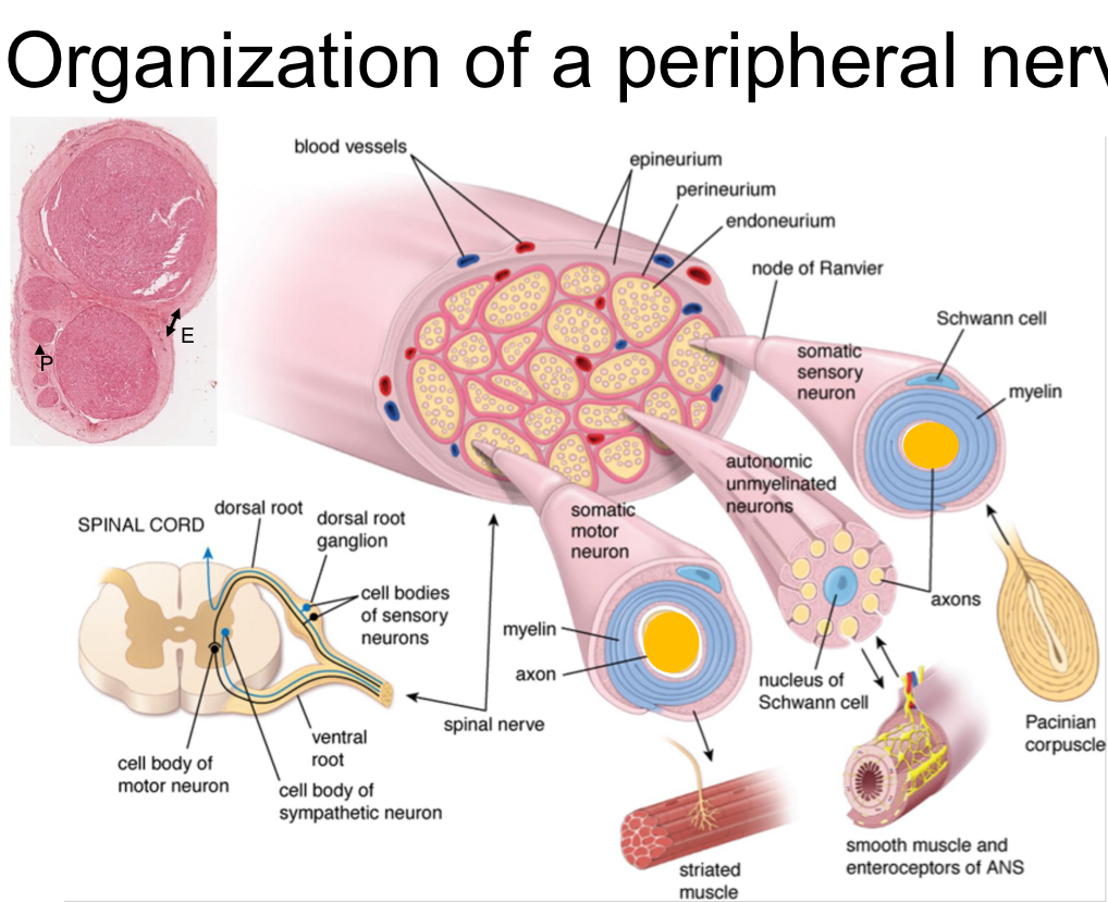 <p>ex: median nerve is comprised of outer connective tissue called <span style="color: red"><strong>epineurium</strong></span> surrounding many individual nerve bundles each wrapped by <span style="color: red"><strong>perineurium</strong></span>. The nerve bundles are comprised of many <span style="color: yellow">somatic sensory, somatic motor, and/or autonomic unmyelinated neurons</span>. Inbetween the different nerve fibers is insulating tissue <span style="color: red"><strong>endometrium. </strong></span>there are also blood vessels in nerves</p>