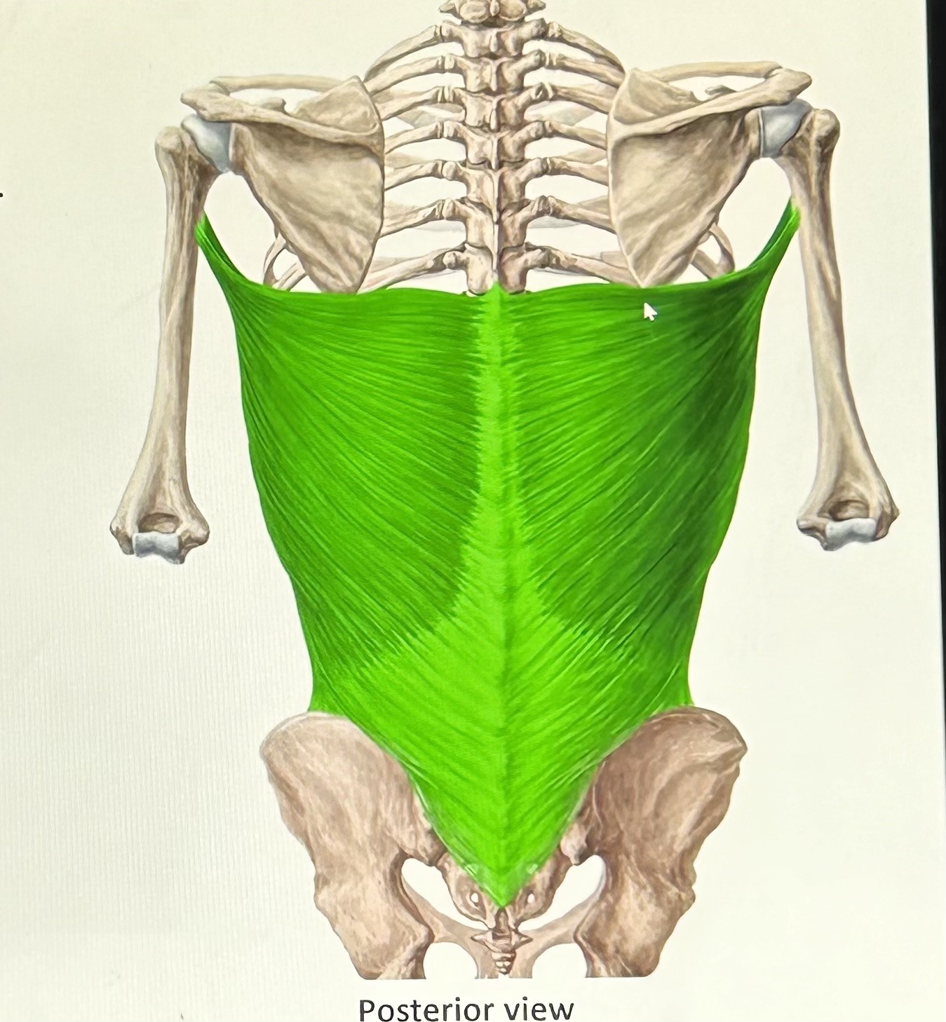 term image
