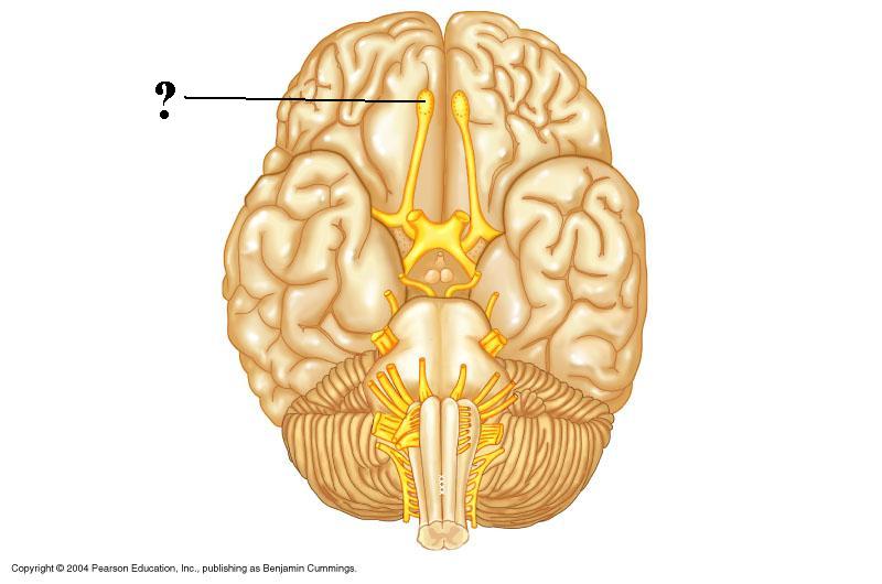 <p><span><span>Identify the indicated structure</span></span></p>