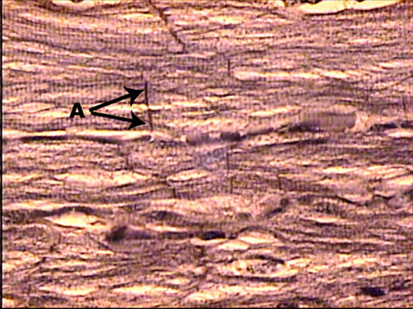 <p>striated, branched fibers</p><p>intercalated discs</p><p>myogenic-can initiate own contraction</p><p>found only in the heart</p><p>function: provide rhythmic contractions</p>