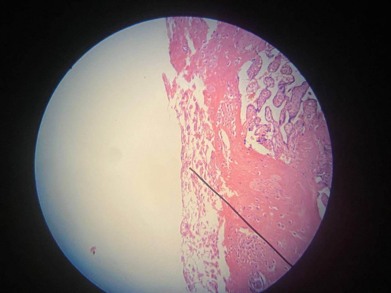term image