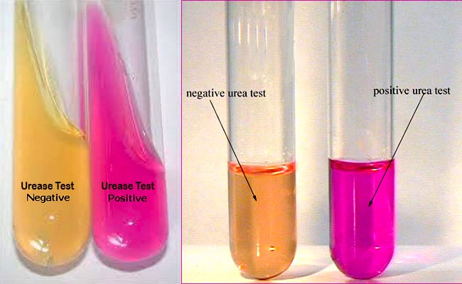 <ul><li><p>Determines the ability of an organism to use <strong><u>urea</u></strong><u> as a source of nitrogen</u> using the enzyme <strong>urease</strong></p></li><li><p>Differentiates <em>Proteus species</em> from other organisms, identifies <em>Heliobacter pylori</em></p></li><li><p>Alkaline byproducts of urease breakdown and turns the media from yellow to → pink/red <strong>(phenol red indicator)</strong></p></li></ul><p></p>