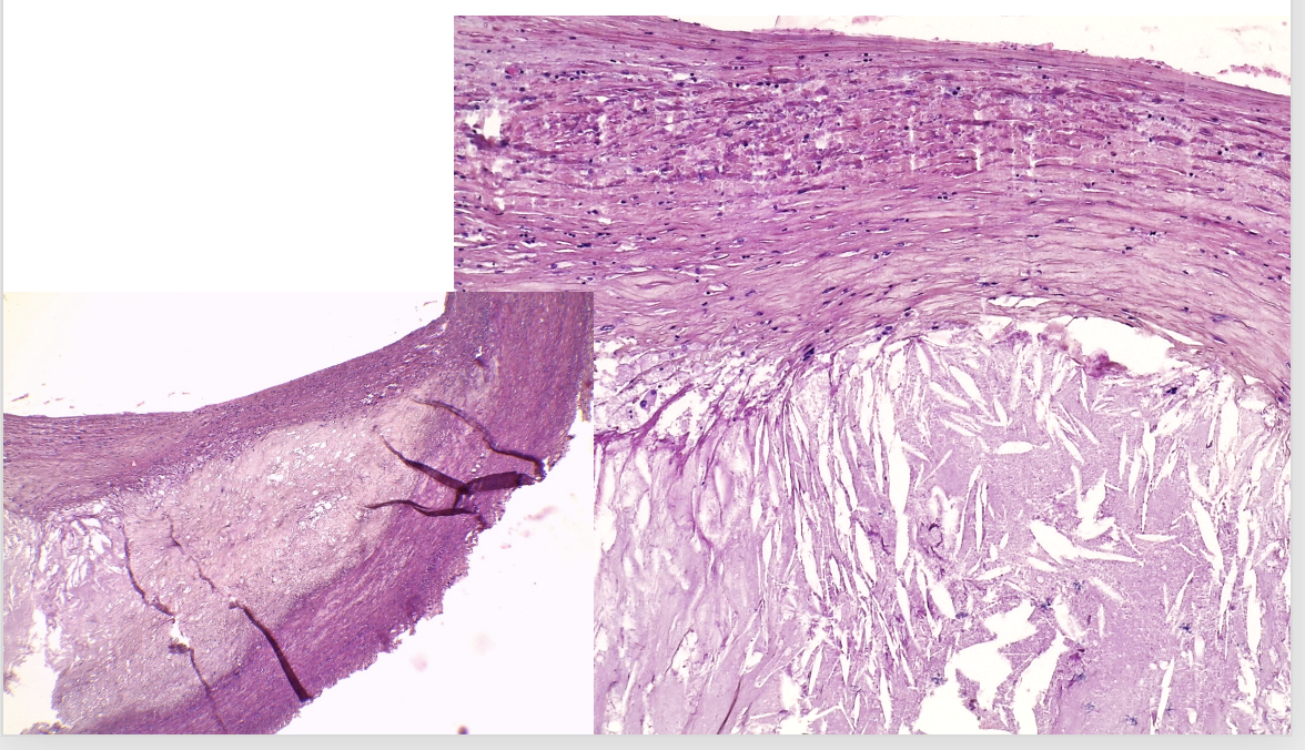 <p>welk preparaat</p>