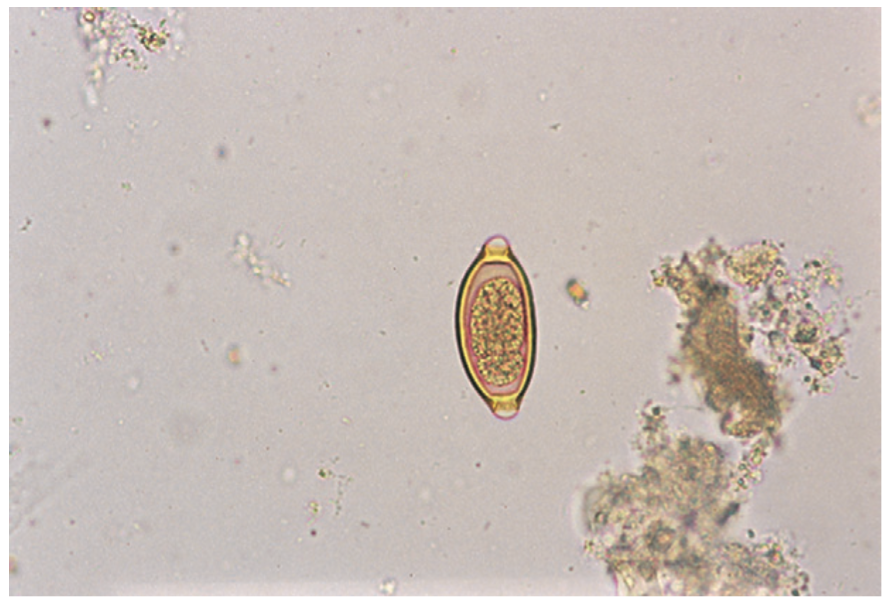 <p>A soil-transmitted helminth also known as whipworm.</p>