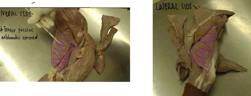 <p><span>Brachial Region (Arm)</span></p>