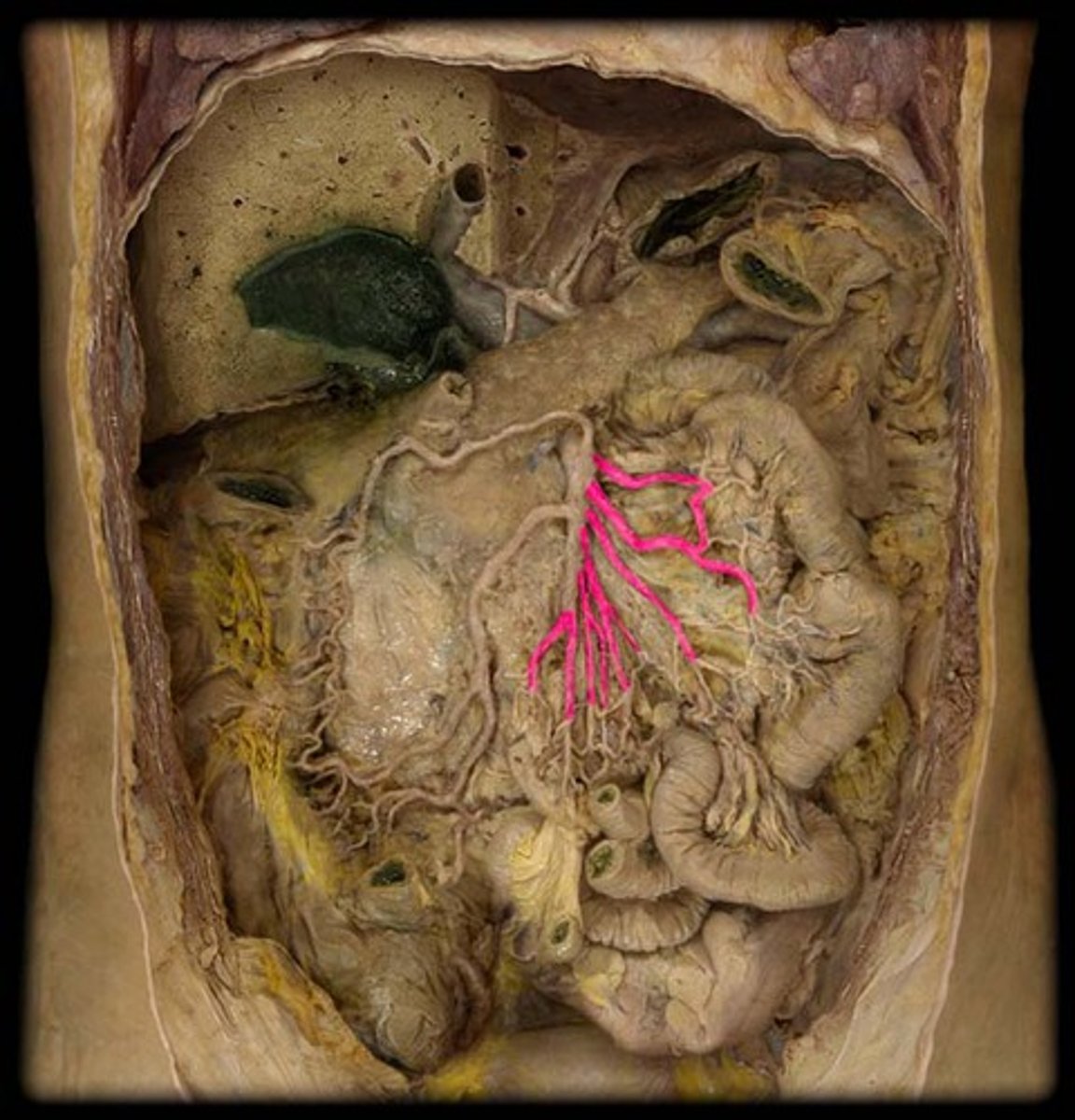 knowt flashcard image