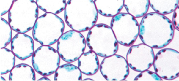 <ul><li><p>Mature parenchyma cells</p></li><li><p>Have thin and flexible primary walls</p></li><li><p>Have a large central vacuole</p></li><li><p>Perform the most metabolic functions</p></li><li><p>(Photosynthesis, cellular respiration, storage, etc)</p></li><li><p>Retain the ability to divide and differentiate</p></li></ul>